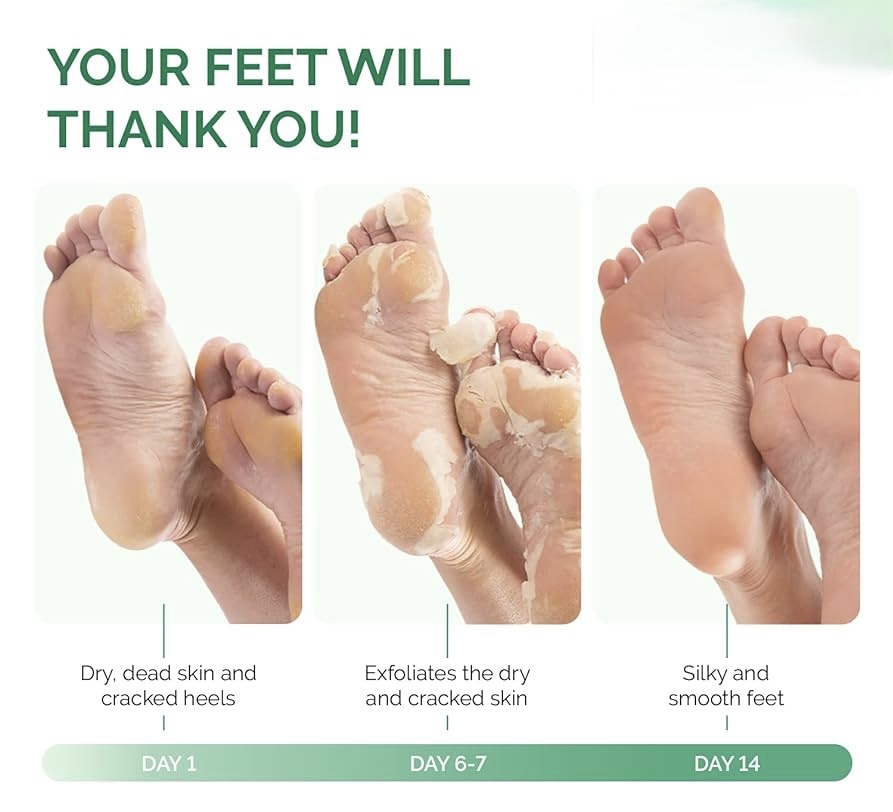 Derma V10 Foot Peeling