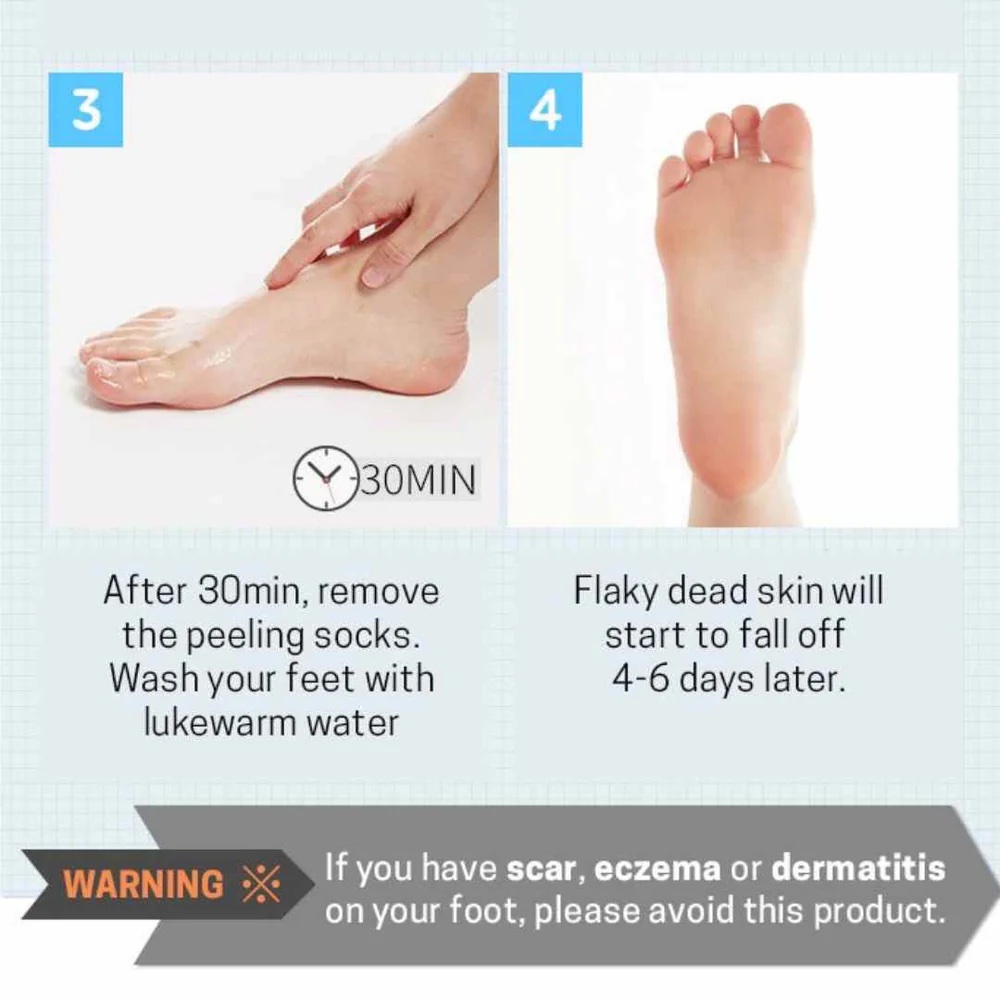 APIEU Soft Foot 30 Minute Peeling Socks